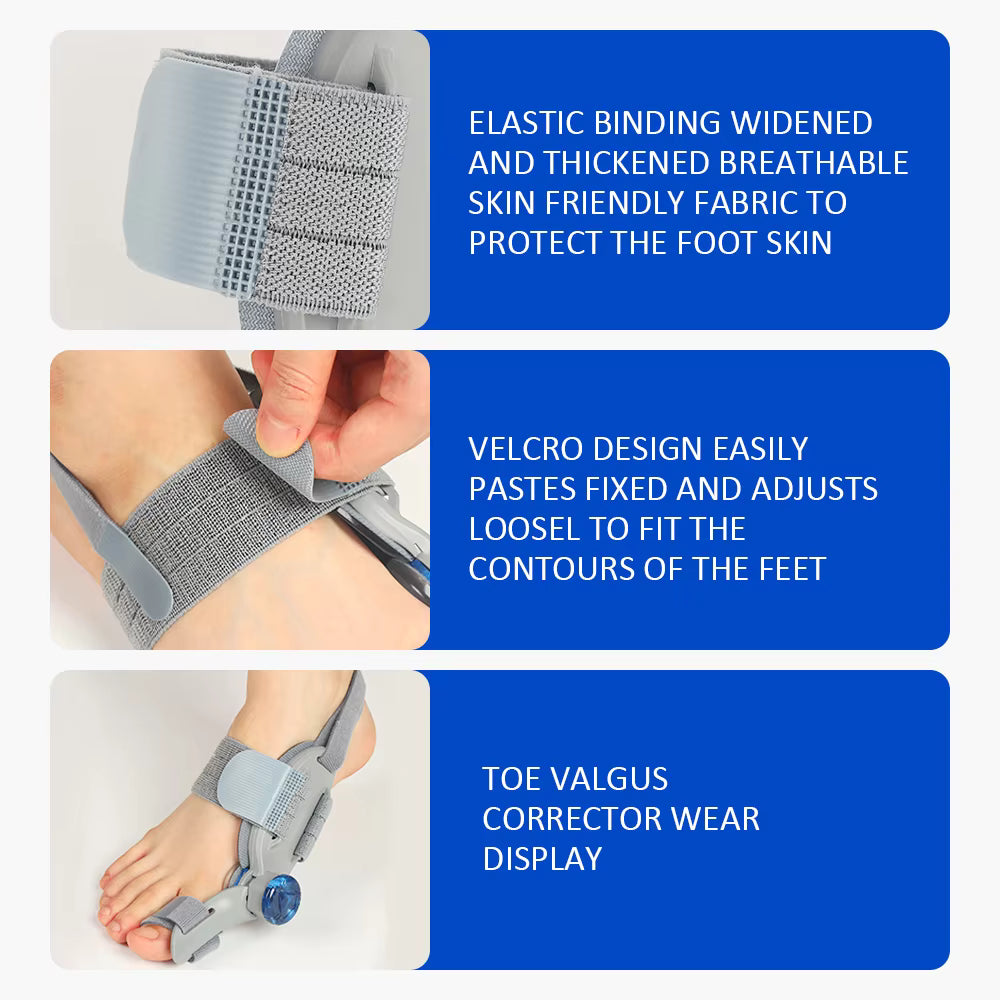 Knob-Adjustable Bunion Corrector & Big Toe Straightener – 180° Rotatable Hallux Valgus Adjuster with Heel Strap & Silicone Cushion