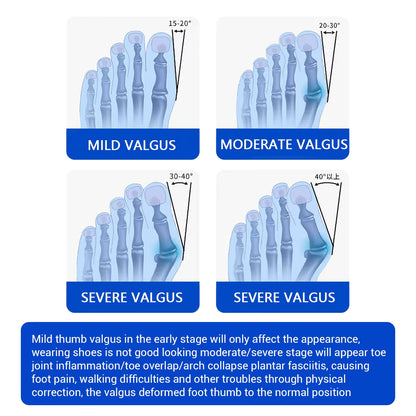 Knob-Adjustable Bunion Corrector & Big Toe Straightener – 180° Rotatable Hallux Valgus Adjuster with Heel Strap & Silicone Cushion